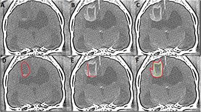 Computed Tomography and Magnetic Resonance Imaging Are Equivalent in Mensuration and Similarly Inaccurate in Grade and Type Predictability of Canine Intracranial Gliomas